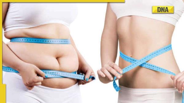 From curd to exercises, these things will help you to lose weight in PCOD