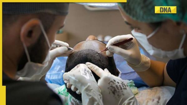 Hair transplant leads to painful death for 30-year-old: How hair transplant can turn fatal